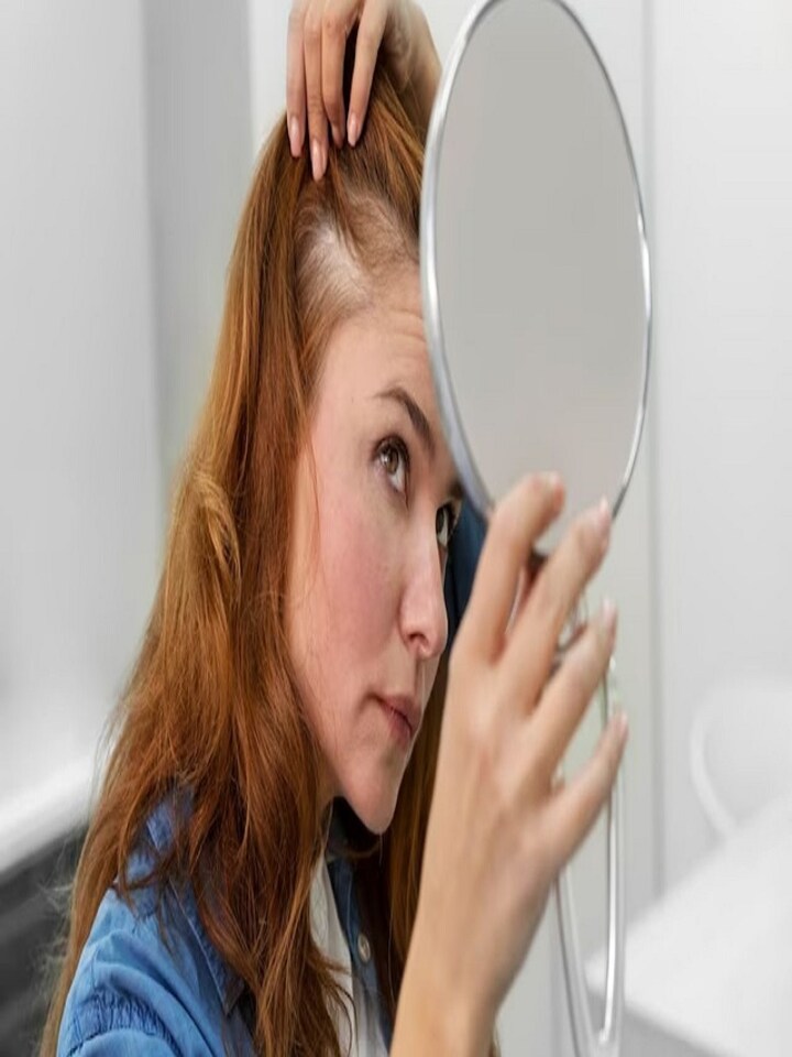 7 science-backed ways to treat receding hairline